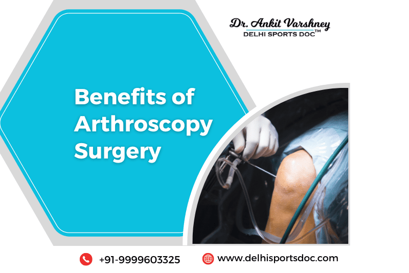 What Is The Benefits Of The Arthroscopic Surgery