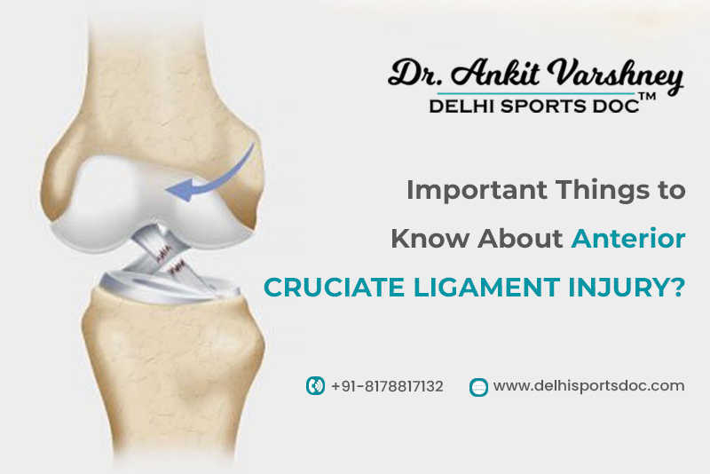 Important Things to Know About Anterior Cruciate Ligament Injury